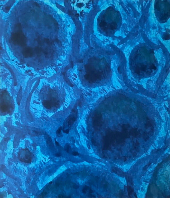 A photo of a monochromatic gouache painting. It depicts a bunch of rounded shapes with various shading, though mostly lacking highlights. Curving lines wrap around the shapes, touching nothing but the lighter colored space between them. Splatters of dark b